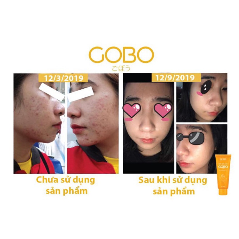 Sữa rửa mặt ngăn ngừa mụn GOBO tuýp mini (10ml)