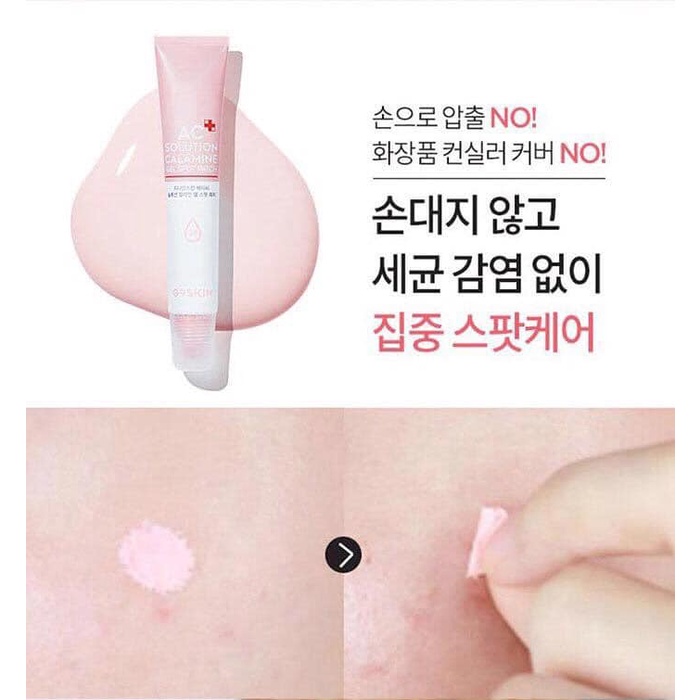 KEM GIẢM MỤN, GIÚP GIẢM SƯNG, LÀM DỊU NỐT MỤN HIỆU QUẢ G9SKIN AC SOLUTION CALAMINE GEL SPOT PATCH 20G CHÍNH HÃNG - 9876