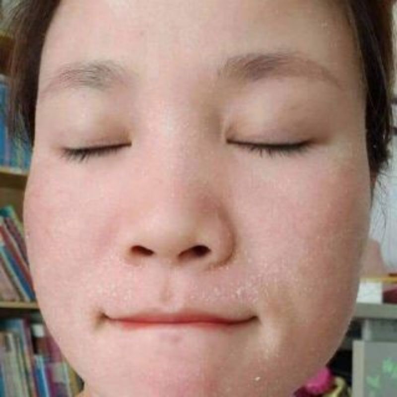 Kem Bong Da Mặt Trắng Da Mờ Thâm Nám