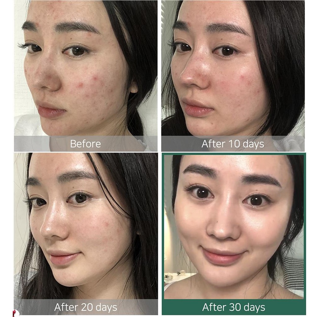 Nước Hoa Hồng Giảm Mụn Some By Mi AHA-BHA-PHA 30 Days Miracle Toner Mini 6ml
