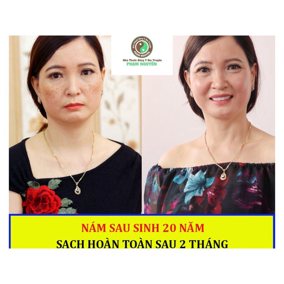 Kem nám tàn nhang, mụn, da thâm không đều màu, kem đông y Phạm Nguyễn handmade