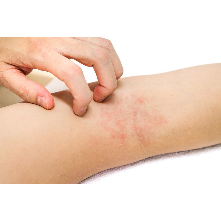 Kem Dưỡng Ẩm 3% Urê - Ziaja Med | BigBuy360 - bigbuy360.vn