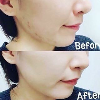 Phấn phủ Cushion Missha Magic Moisture