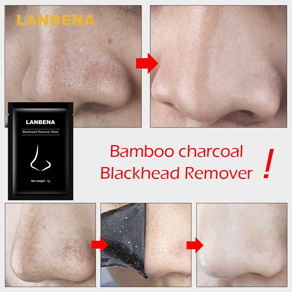 Sale 70% Mặt nạ lột mụn đầu đen cho mũi LANBENA hiệu quả,  Giá gốc 20000 đ - 9F37-2