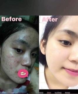 Serum Tảo Biển soHERBs 10ml