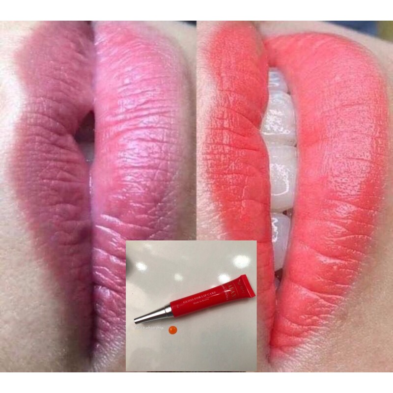 Dưỡng kích màu môi chống thâm sau phun săm Galaxy