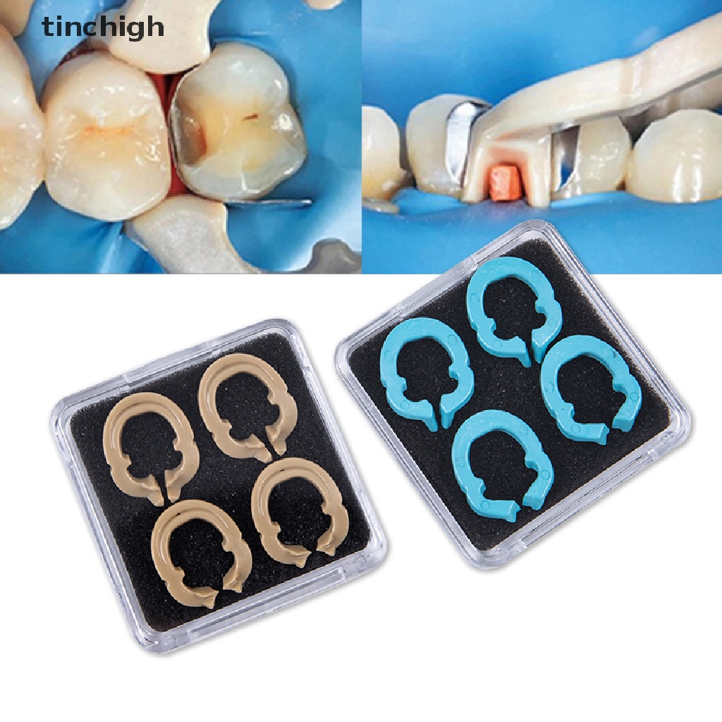 Set 4 Vòng Kẹp Nhựa Chuyên Dụng Cho Nha Khoa