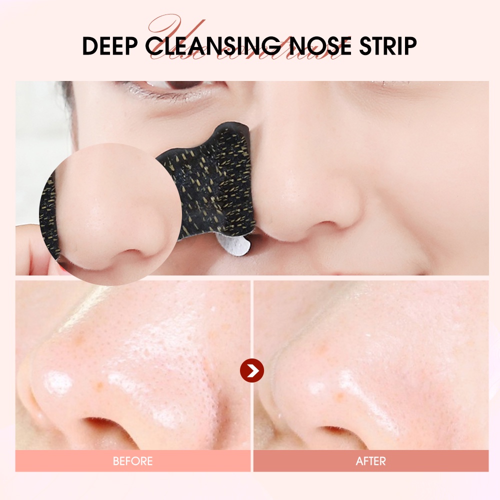 Mặt Nạ Lột Mụn Đầu Đen Làm Sạch Sâu Lỗ Chân Lông