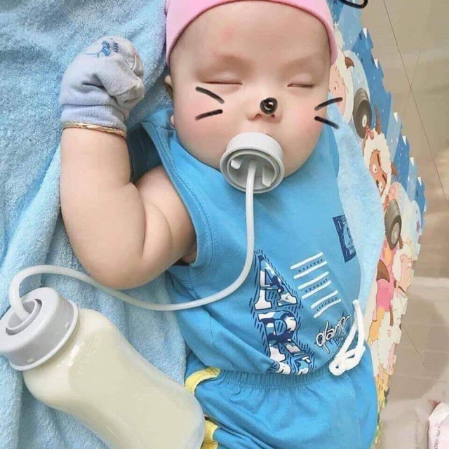 Bình sữa rảnh tay UMOM