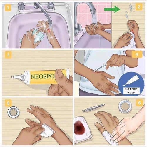 Kem mỡ Neosporin bôi bỏng, sẹo, đứt tay - Neosporin Original Ointment 14.2g