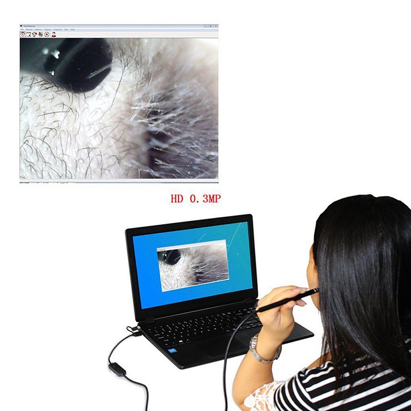 Bộ Dụng Cụ Nội Soi Vệ Sinh Tai USB HD Kèm Camera Mini