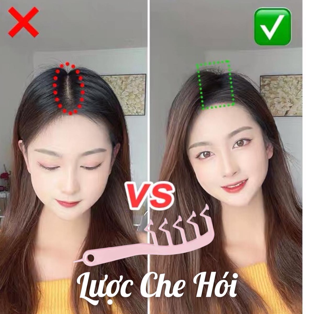  Lược Che Hói Che Khe Da Đầu