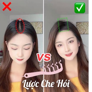  Lược Che Hói Che Khe Da Đầu
