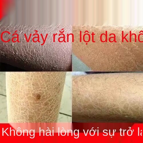 Nam Kinh Tong Ren Tang Kem Tẩy Tế Bào Chết Toàn Thân Đi Da Tẩy Da Chết 疙瘩 Để Tẩy Tế Bào Chết Sắc Tố Melanin Sát Nách Trắng Học Sinh Sinh Viên