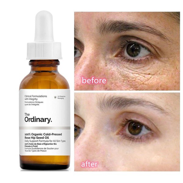 Serum giảm quầng thâm và bọng mắt The Ordinary Caffein Solution 5% + EGCG 30ml - Mecskincare