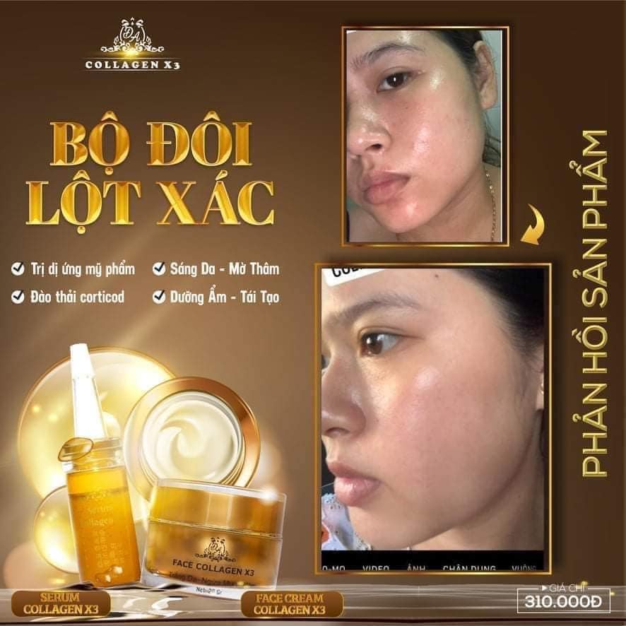 Serum nám X3 collagen 20ml Chính hãng