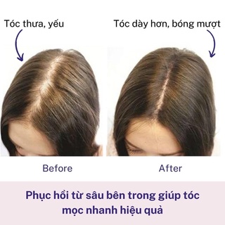 [MẪU MỚI] Cặp Xả Gội Biotin