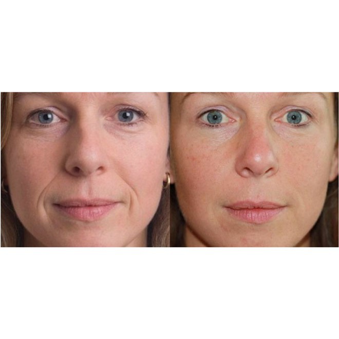 Tinh chất chống lão hóa & cấp nước The Ordinary Matrixyl 10% +HA(30ml) | BigBuy360 - bigbuy360.vn