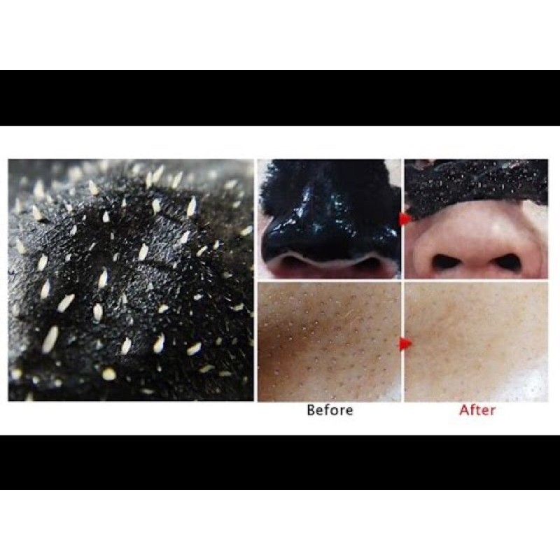 GEL LỘT MỤN THAN TRE HOẠT TÍNH