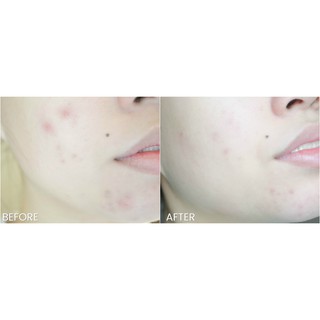 Serum cấp nước 9wishes HYDRA SKIN AMPULE SERUM