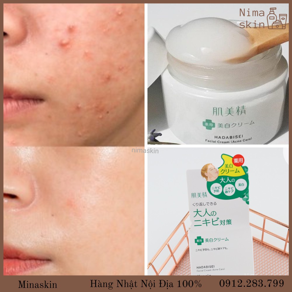 (Hàng nội địa Nhật) Kem dưỡng ngăn ngừa mụn và dưỡng trắng Kracie Hadabisei Acne