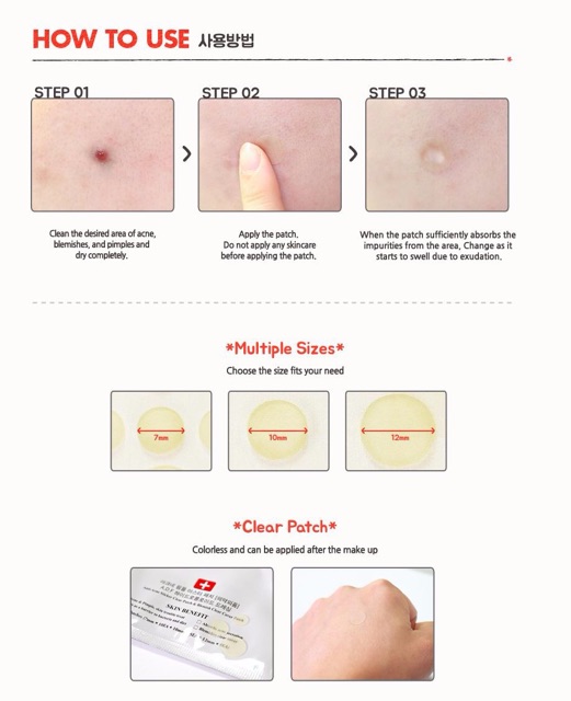 Miếng Dán Mụn Cosrx Acne Pimple Master Patch