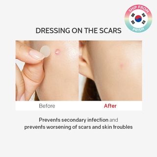 Miếng Dán Hỗ trợ giảm mụn COSRX