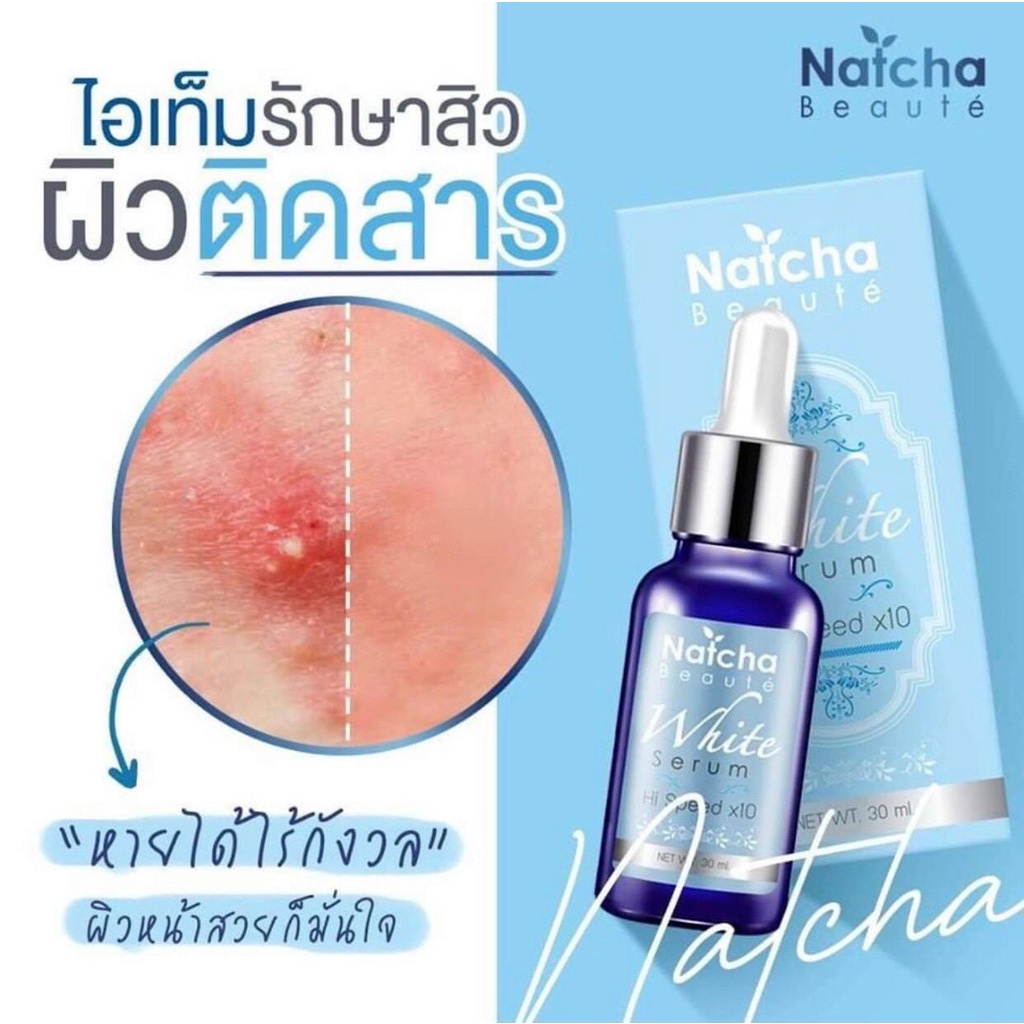 Serum Natcha - serum xóa nám, tàn nhang, xóa thâm giúp da đẹp, chính hãng,nội địa Thailand