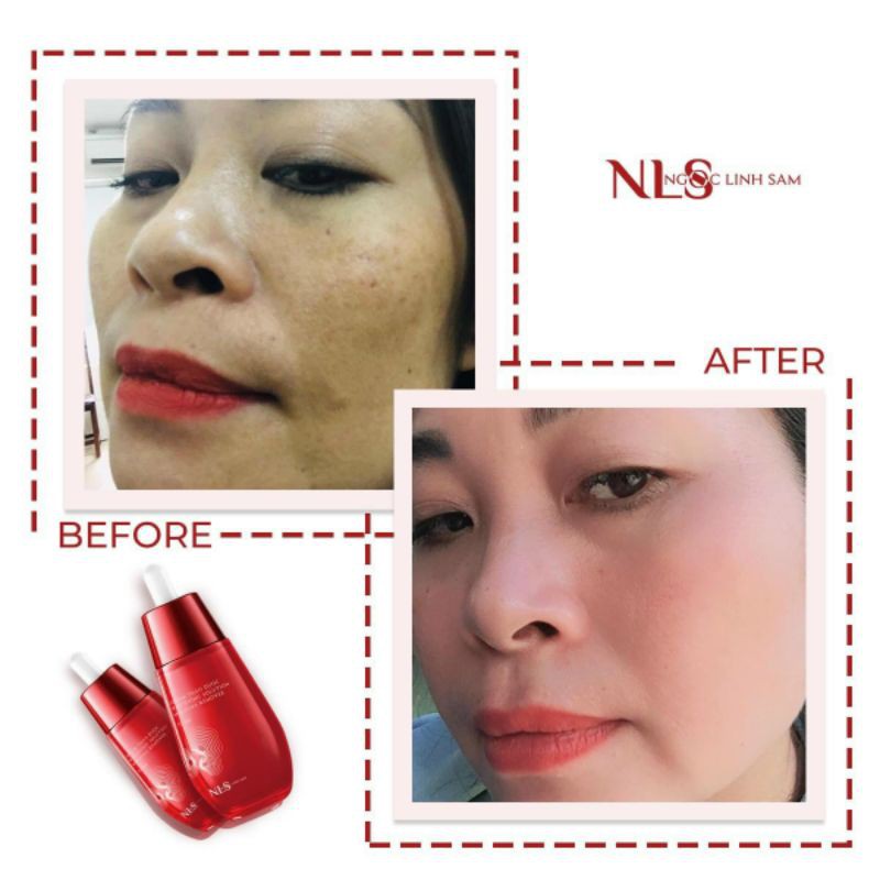 VUA XÓA NÁM, TÀN NHANG, MỤN LINH CHI ĐỎ NGỌC LINH SÂM | BigBuy360 - bigbuy360.vn