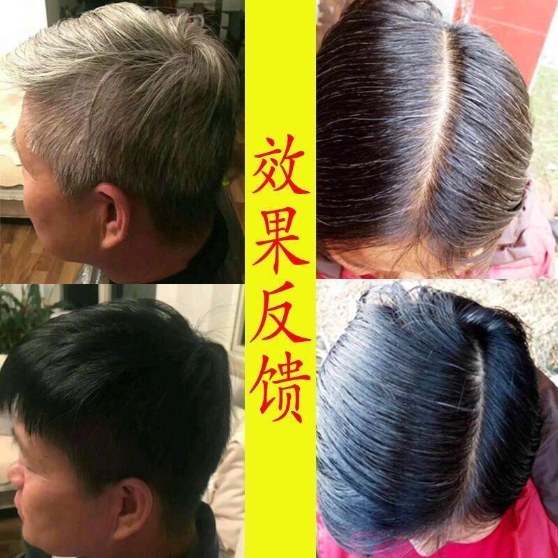 Tinh Chất Thảo Dược Tự Nhiên Ngăn Rụng Tóc Giúp Tóc Đen Trắng 100ML