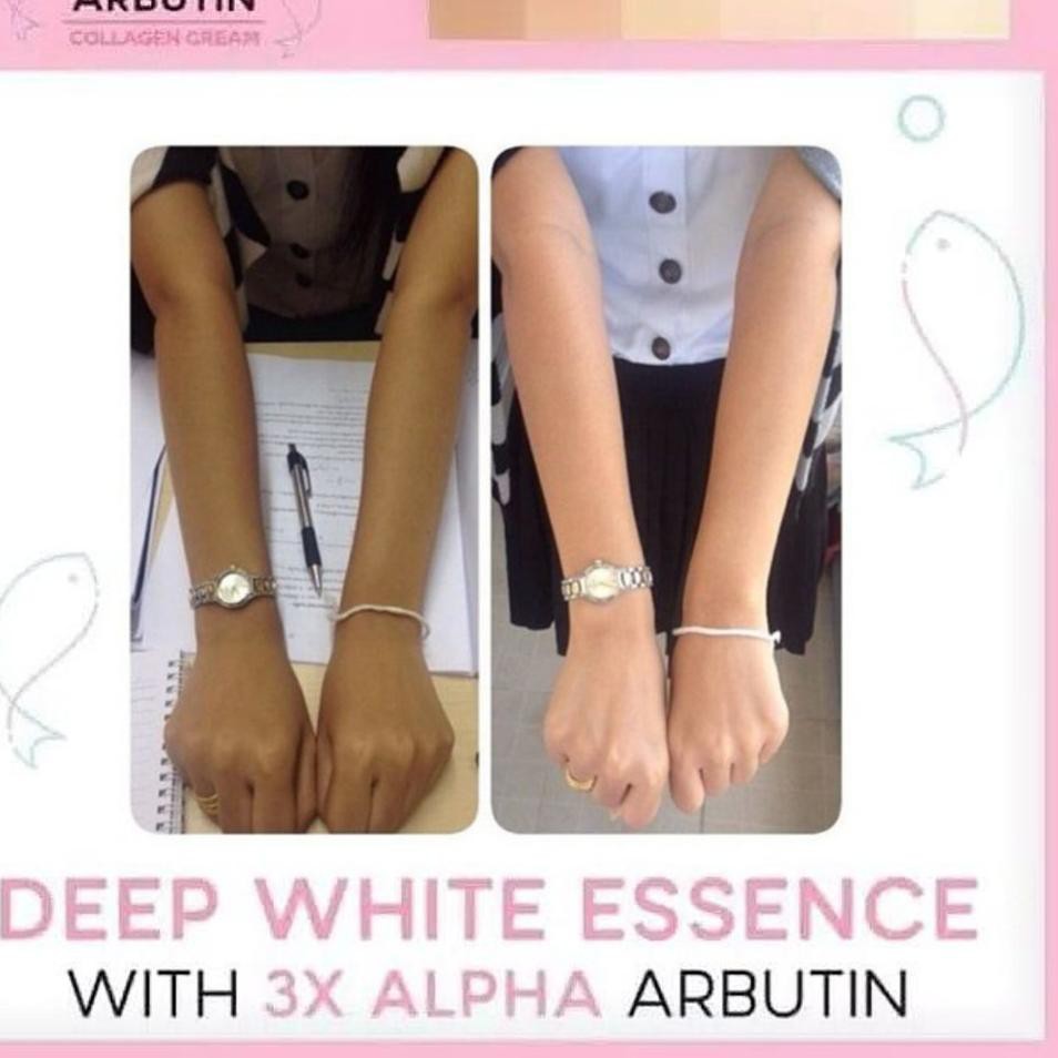 (Hàng Mới Về) Xà Phòng Làm Trắng Da Chứa Collagen Alpha Arbutin 3 Plus