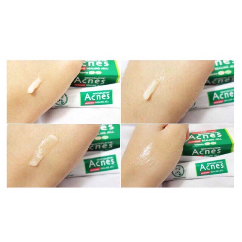 gel ngừa mụn Acnes sealing gel 18g