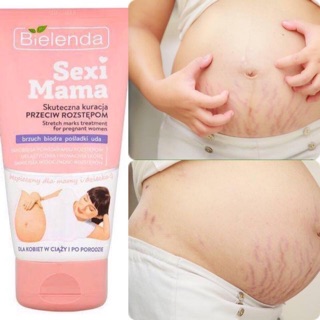 Kem siêu trị rạn trước và sau sinh KREM BIELENDA SEXY MAMA - hàng xách tay balan