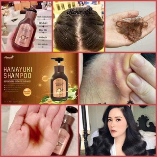 Dầu Gội Đầu HANAYUKI Shampoo