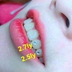 Đá đính răng combo 20 viên kèm keo và bút dán đá sáng đẹp tự đính tại nhà ko cần ra nha khoa