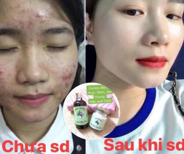 Đông y sắc dược