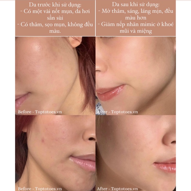 Serum Bielenda Retinol Neuro/ Mezo Skin Clinic 30ml trẻ hoá, làm da căng bóng, mờ thâm sẹo