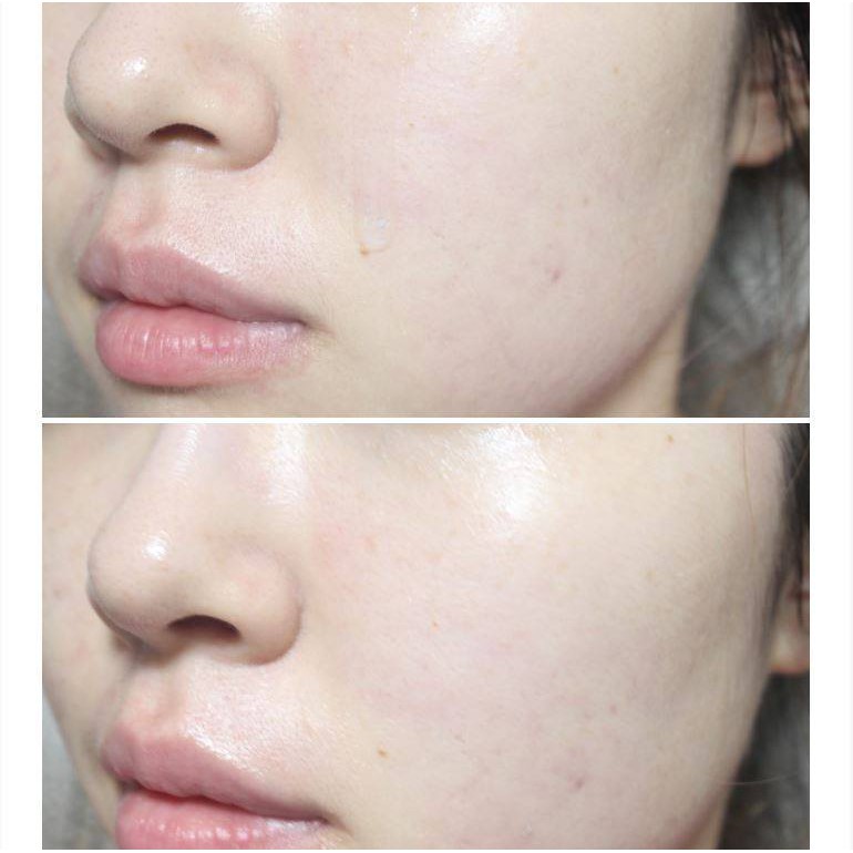 Serum Balance Hyaluronic chính hãng | BigBuy360 - bigbuy360.vn