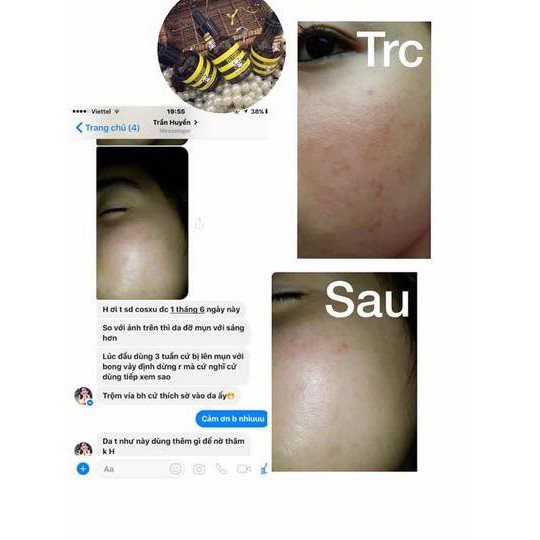 Serum Dưỡng Da khỏe, Căng Bóng, Phục Hồi Tái Tạo KOSXU HÀN QUỐC