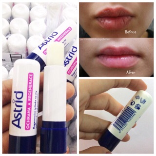 SON DƯỠNG MÔI ASTRID TỪ MỠ HƯƠU