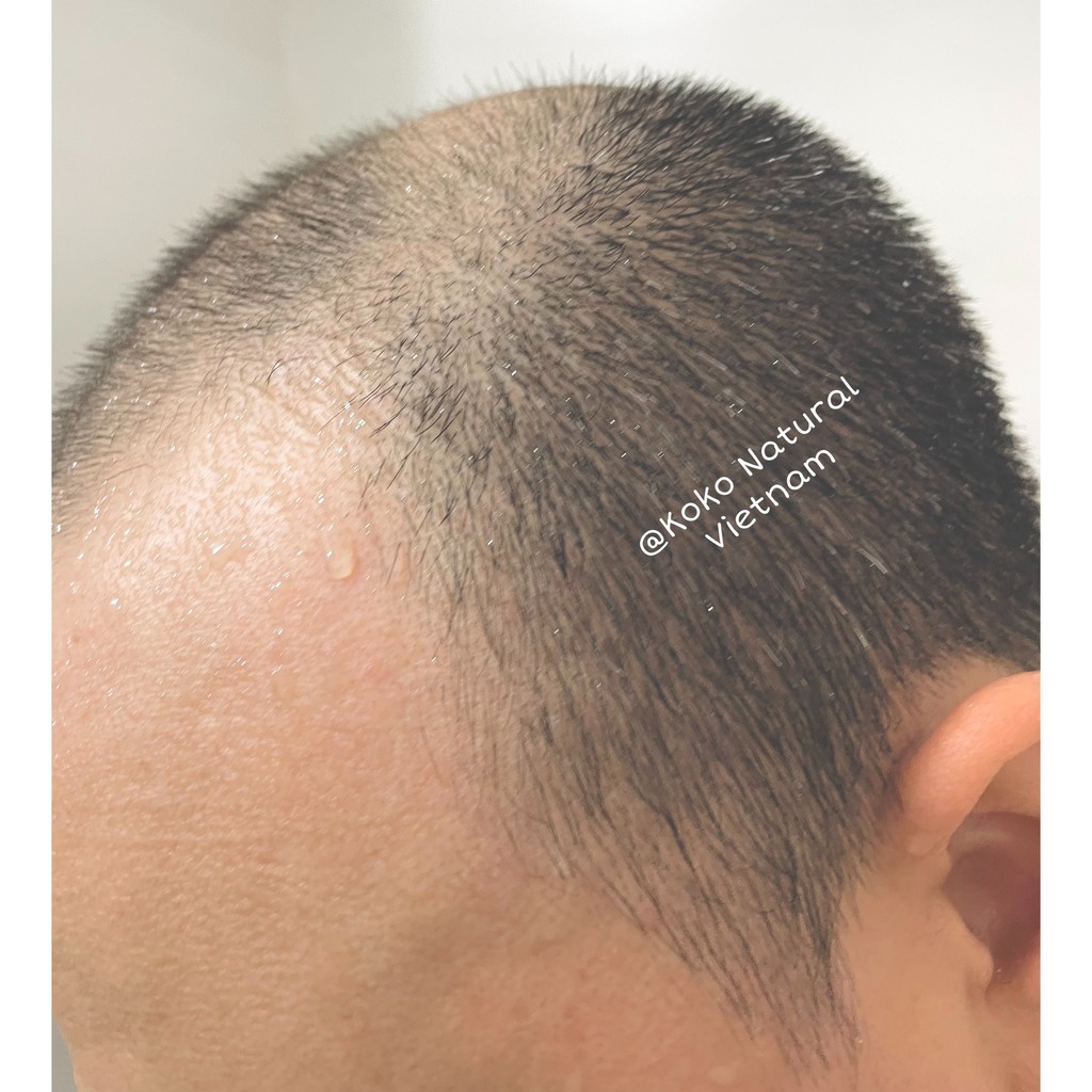 Dầu gội thảo dược bồ kết kích thích mọc tóc nhanh và giảm rụng tóc - KoKo Natural Official | BigBuy360 - bigbuy360.vn