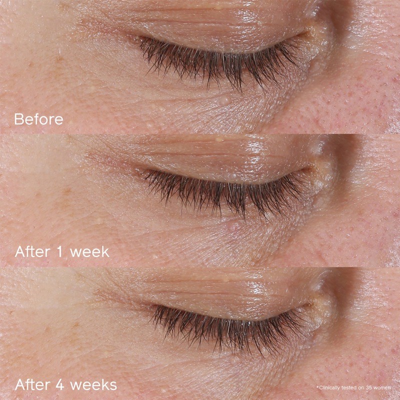 🌸 Kem làm giảm nhăn vùng mắt Shiseido Befeniance Wrinkle Smoothing Eye Cream minisize