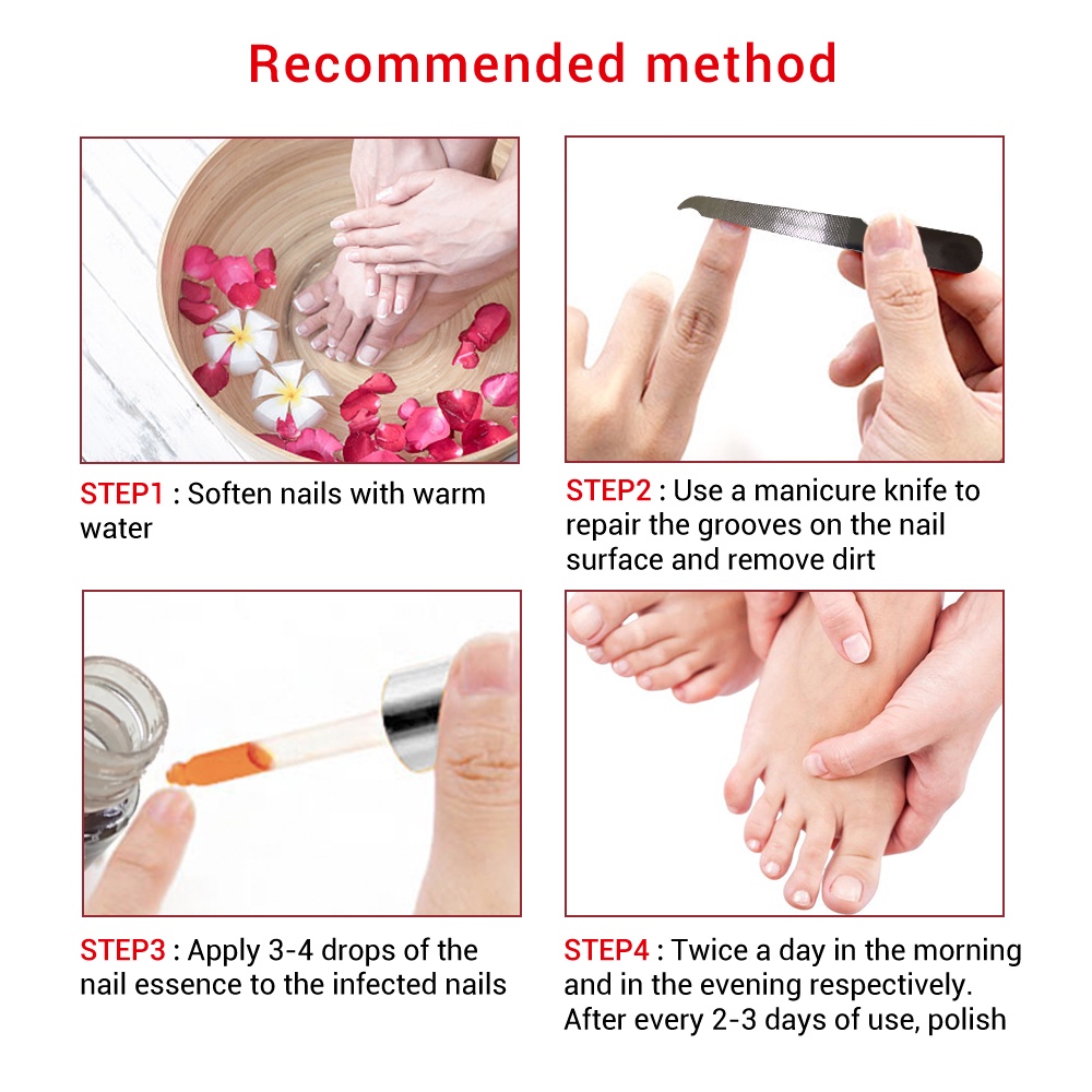 Tinh Chất Lanbena Hỗ Trợ Giảm Bệnh Nấm Móng 15Ml- Vibesvietnam