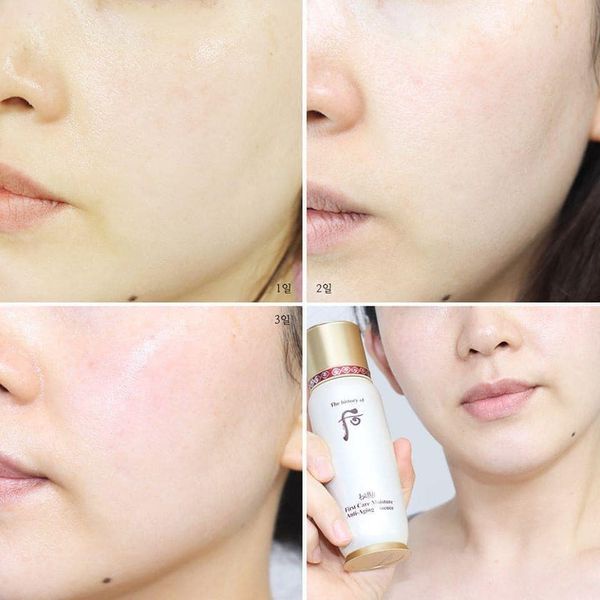 Set Tinh Chất Khởi Nguồn Whoo Bichup First Care Moisture Anti-Aging Essence Limited 2022
