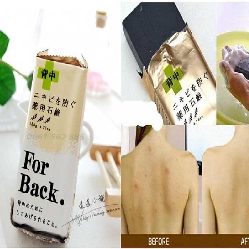 Xà Phòng Forback Tẩy Da Chết Giảm Thâm Mụn Lưng 135g