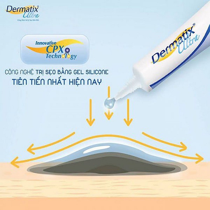 Kem mờ sẹo Dermatix Ultra tuýp 15g 7g nhập khẩu USA - làm phẳng và mờ sẹo lồi, sẹo thâm, sẹo phì đại, nám rạn da