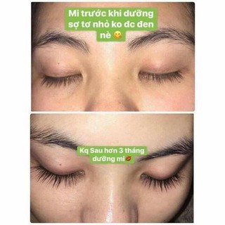 [CÓ SẴN] Dưỡng Mi Eveline 8 in 1 Total Action Lash Therapy Professional | BigBuy360 - bigbuy360.vn