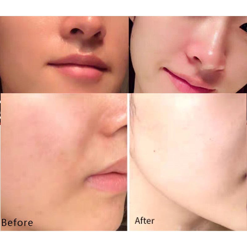 1 MIẾNG mặt nạ sủi bọt thải độc Detox da than hoạt tính BUBBLE MASK