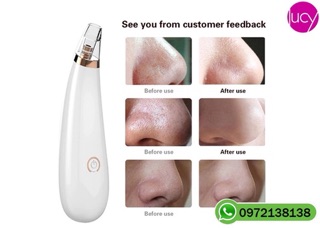 MÁY HÚT MỤN CẦM TAY BLACK HEAD INSTRUMENT chính hãng giá rẻ