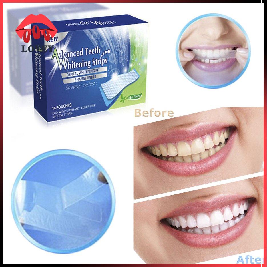lovey★28PCS/SET Natural Advanced White Gel Teeth Whitening Strips Oral Hygiene Care